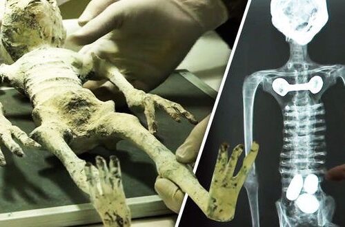 A skeleton with hands on it and an x-ray.